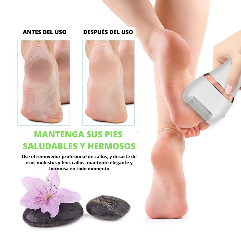 Removedor de Callos Electico USB