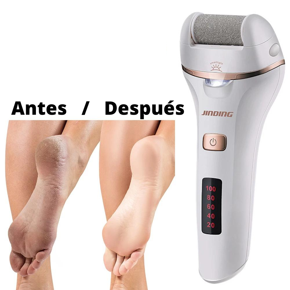 Removedor de Callos Electico USB