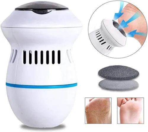 Removedor de Callos Electrico Recargable